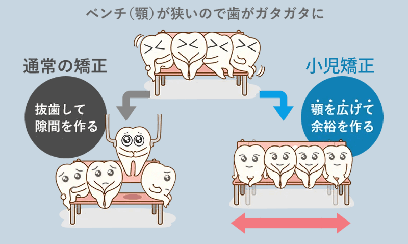 顎の成長を利用した骨格的な矯正