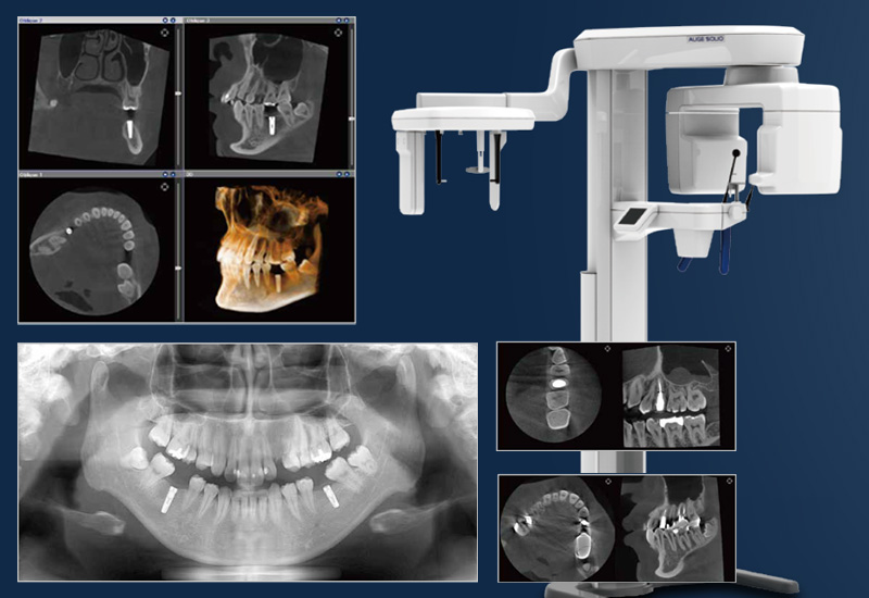 歯科用CT AUGE SOLIO ZCMセファロ付き