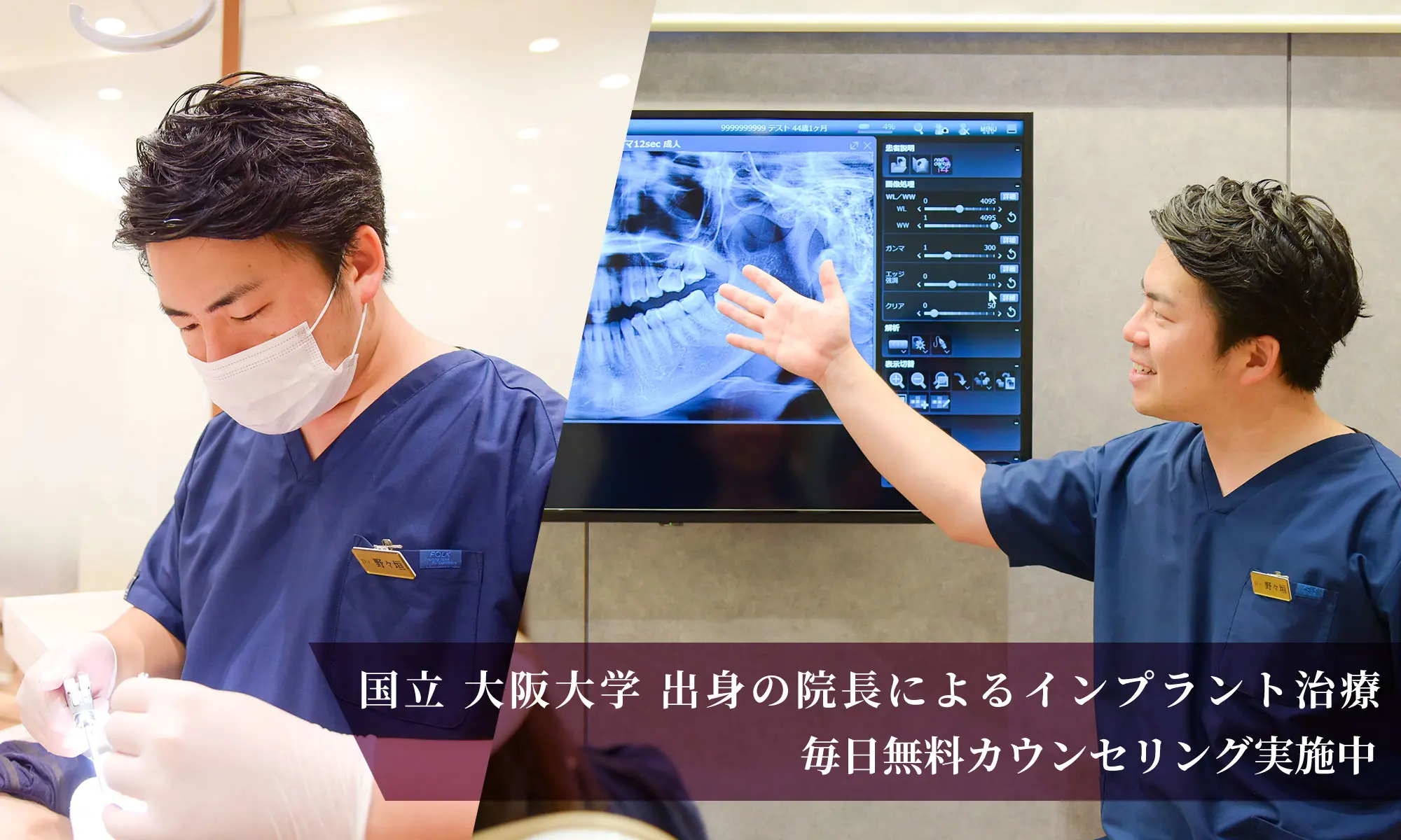 名東区 インプラント