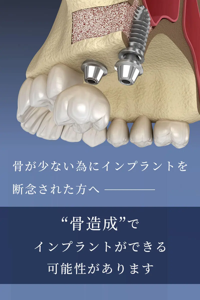 藤が丘 インプラント