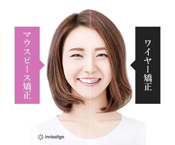 矯正治療の比較
